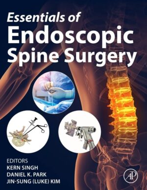 Essentials of Endoscopic Spine Surgery Without videos